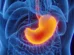 Gastroenterologista lista medicamentos que prejudicam o estômago