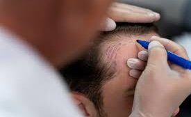 Vaidade masculina em alta: os 3 procedimentos mais procurados