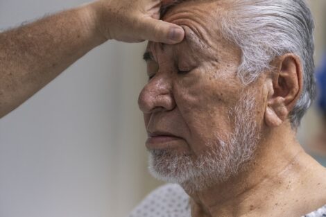 Blefaroplastia funcional: quando a cirurgia recupera a visão
