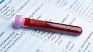 Guia completo sobre o estradiol e seu exame
