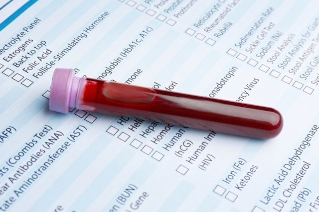 Guia completo sobre o estradiol e seu exame