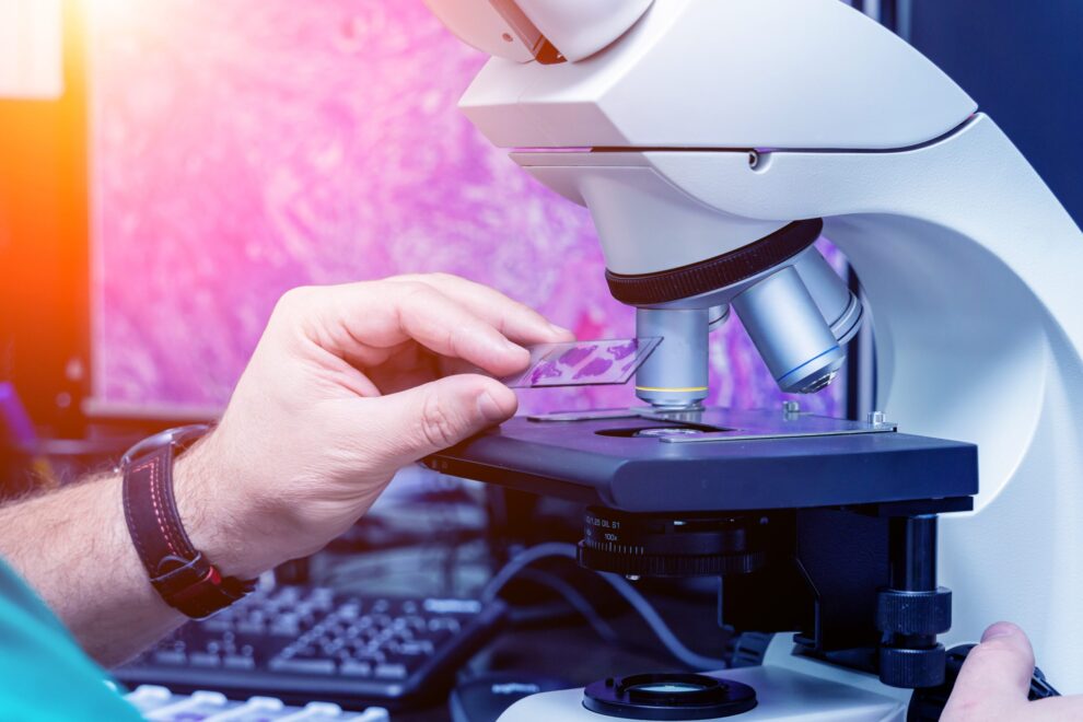 Câncer em jovens e envelhecimento biológico: estudo aponta correlação