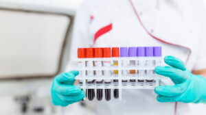 Testosterona total e livre: definição, função e interpretação dos resultados