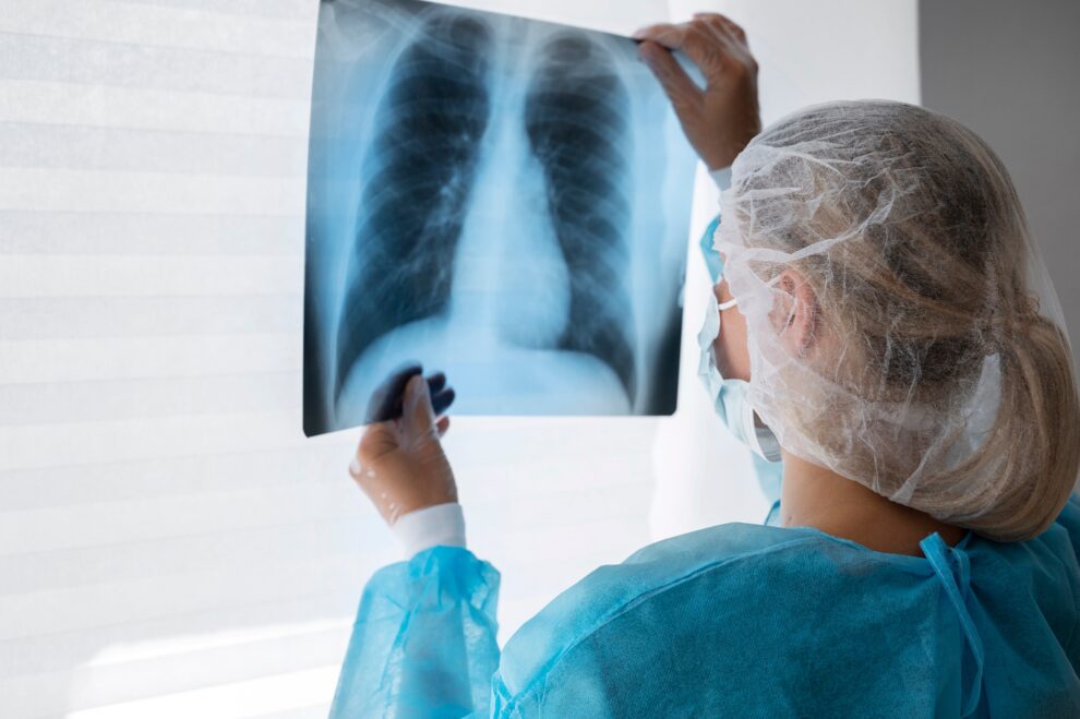 Anvisa aprova Tyvaso para hipertensão pulmonar